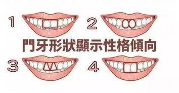 门牙连冠图片,揭秘牙齿连冠之美